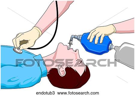 Endotracheal Intubation-Checking Breath Sounds View Large Illustration Drawing - Endotracheal Intubation-Checking Breath Sounds. Fotosearch