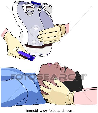 Drawing - In-Line Immobilization of Head. Fotosearch