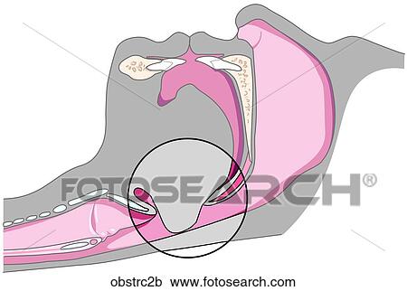 Clipart - . Fotosearch