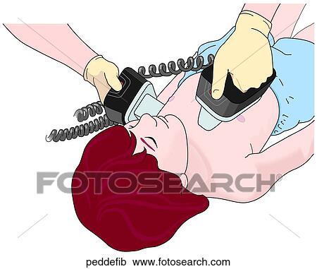 Pediatric Defibrillation View Large Illustration Clipart - Pediatric Defibrillation. Fotosearch