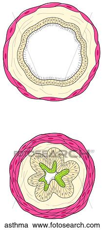 Section of Bronchi View Large Illustration Clipart - Section of Bronchi. Fotosearch