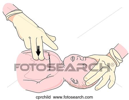Clip Art - Child CPR. Fotosearch