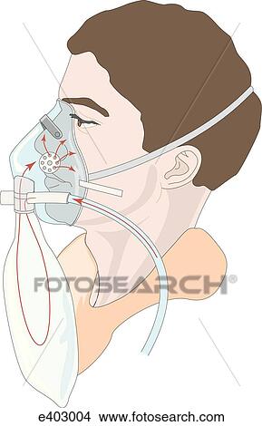 Bag-valve-mask unit View Large Illustration Stock Illustration - Bag-valve-mask unit. Fotosearch