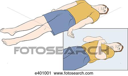 Brain injury responses View Large Illustration Clip Art - Brain injury responses. Fotosearch
