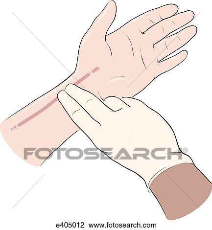 Checking radial pulse View Large Illustration Drawing - Checking radial pulse. Fotosearch