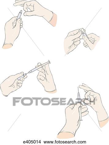 Drawing up a drug from an ampule View Large Illustration Stock Illustration - Drawing up a drug from an ampule. Fotosearch