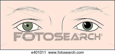Examination of the pupils, unequal View Large Illustration Clip Art - Examination of the pupils, unequal. Fotosearch