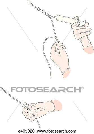 Giving drugs IV View Large Illustration Clipart - Giving drugs IV. Fotosearch