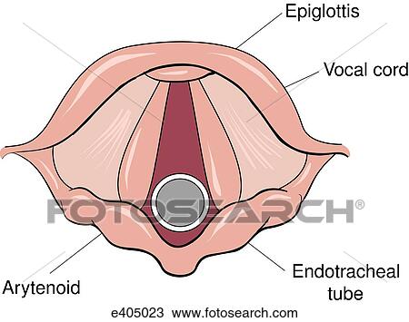 Glottic opening as seen through MacIntosh laryngoscope. View Large Illustration Drawing - Glottic opening as seen through MacIntosh laryngoscope.. Fotosearch