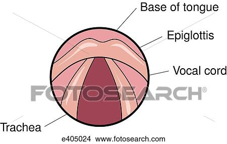 Stock Illustration - Glottic opening as seen through straight laryngoscope. Fotosearch