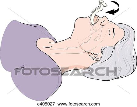 Insertion of oropharyngeal airway in adult, step 1 View Large Illustration Stock Illustration - Insertion of oropharyngeal airway in adult, step 1. Fotosearch