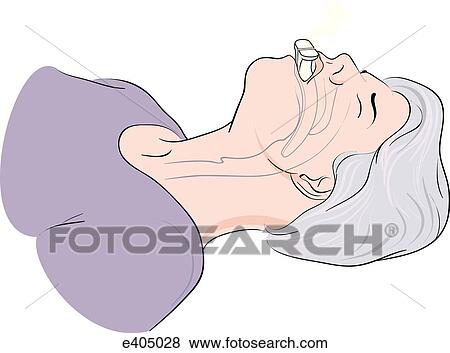 Insertion of oropharyngeal airway in adult, step 2 View Large Illustration Stock Illustration - Insertion of oropharyngeal airway in adult, step 2. Fotosearch