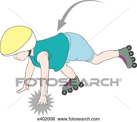 Mechanism of injury, direct force View Large Illustration Stock Illustration - Mechanism of injury, direct force. Fotosearch