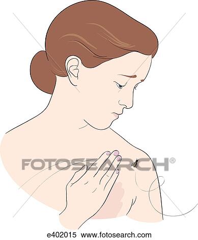 Poisons entering body, injection View Large Illustration Stock Illustration - Poisons entering body, injection. Fotosearch