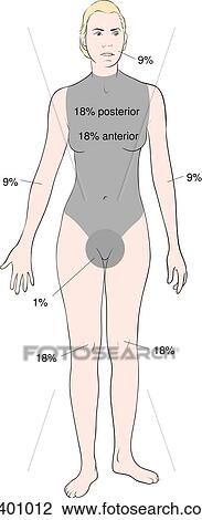 Drawing - Rule of nines, adult. Fotosearch