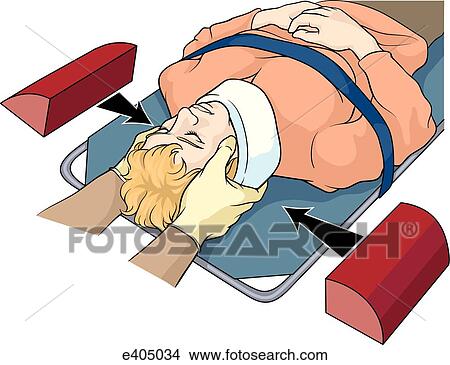 Stabilizing patient's head A View Large Illustration Stock Illustration - Stabilizing patient's head A. Fotosearch