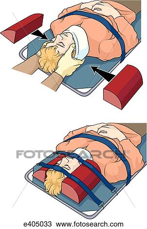 Stabilizing patient's head View Large Illustration Drawing - Stabilizing patient's head. Fotosearch