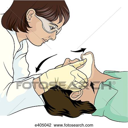 Triple airway maneuver 1 View Large Illustration Drawing - Triple airway maneuver 1. Fotosearch