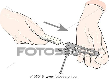 Stock Illustration - Tubex system, step 2. Fotosearch