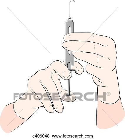 Stock Illustration - Tubex system, step 4. Fotosearch