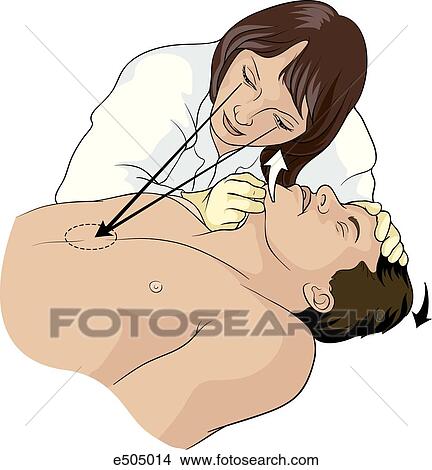 Stock Illustration - A female EMT is using the "look, listen, and feel for breathing" technique for diagnosing respiratory arrest.. Fotosearch