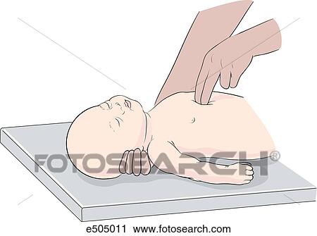 Chest compressions for an infant. One or two fingers only are used as left hand is placed under infant's neck to tilt head backwards. View Large Illustration Clip Art - Chest compressions for an infant. One or two fingers only are used as left hand is placed under infant's neck to tilt head backwards.. Fotosearch