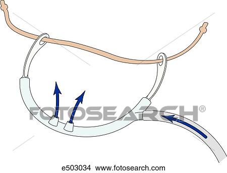 Illustration of a nasal catheter used by rescue teams during transport of victims. Arrows show direction of oxygen. View Large Illustration Stock Illustration - Illustration of a nasal catheter used by rescue teams during transport of victims. Arrows show direction of oxygen.. Fotosearch