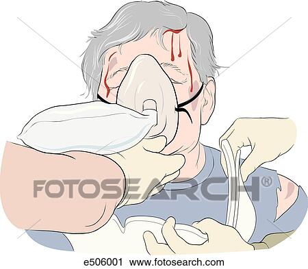 Paramedics are treating an accident victim. One rescuer stabilizes the patient and mask while another begins to apply a cervical collar. View Large Illustration Clip Art - Paramedics are treating an accident victim. One rescuer stabilizes the patient and mask while another begins to apply a cervical collar.. Fotosearch