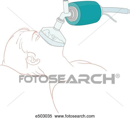 Stock Illustration - Patient wearing a non-rebreathing mask. Arrows show direction of airflow.. Fotosearch