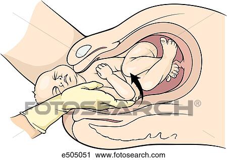(step, 2), 手, の, 胎児, ある, つかまれる, 下に, 陰部の symphysis, そして, 腕, ある, 延長, 前方へ, 側,  の, fetusu0027, face. クリップアート