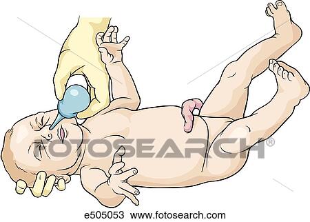 Drawing - The baby is laid on a flat surface while the nose and mouth is suctioned out with a bulb syringe.. Fotosearch