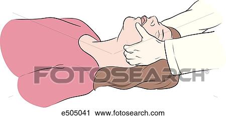 Clip Art - Three step procedure for applying a pocket mask to a victim. (Step 1) Perform triple airway maneuver from the vertex.. Fotosearch