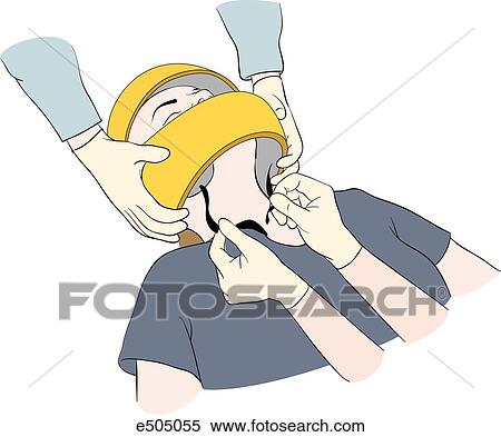 Three step process for removing a helmet from an accident victim. (Step 1) The rescuer cuts or loosens the strap at the D-rings while another rescuer maintains inline traction. View Large Illustration Stock Illustration - Three step process for removing a helmet from an accident victim. (Step 1) The rescuer cuts or loosens the strap at the D-rings while another rescuer maintains inline traction.. Fotosearch