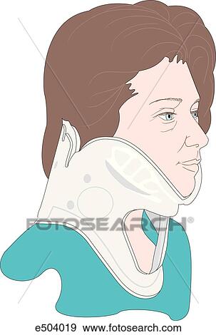 Woman wearing one piece cervical collar. View Large Illustration Stock Illustration - Woman wearing one piece cervical collar.. Fotosearch