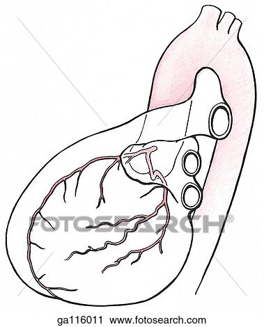 Clip Art - A simple orientation drawing for a left coronary arteriogram showing the left coronary artery stemming near the aortic valve. Corresponding arteriogram is figure 1. 47D.. Fotosearch