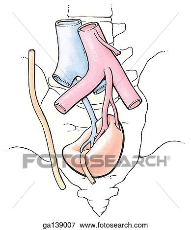 Stock Illustration - Anterior view of a horseshoe kidney. The right and left kidneys are fused in the midline.. Fotosearch