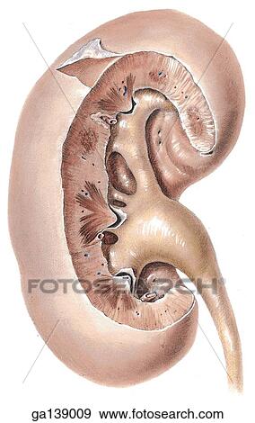 Anterior view of a kidney. Anteriuor lip of the renal sinus has been cut away to expose the renal pelvis and the calices. View Large Illustration Stock Illustration - Anterior view of a kidney. Anteriuor lip of the renal sinus has been cut away to expose the renal pelvis and the calices.. Fotosearch