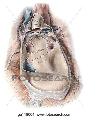 Anterior view of pericardial sac interior made visible upon removal of the heart. The severed ends of eight major blood vessels and the oblique pericardial sinus are the main anatomical landmarks. View Large Illustration Stock Illustration - Anterior view of pericardial sac interior made visible upon removal of the heart. The severed ends of eight major blood vessels and the oblique pericardial sinus are the main anatomical landmarks.. Fotosearch