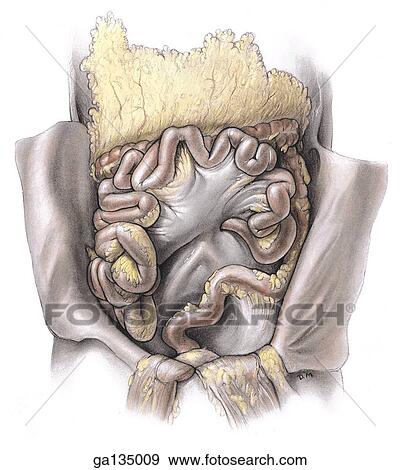 Stock Illustration - Anterior view of small and large intestines in situ, ileum reflected to reveal mesentery, sigmoid colon, and aorta.. Fotosearch