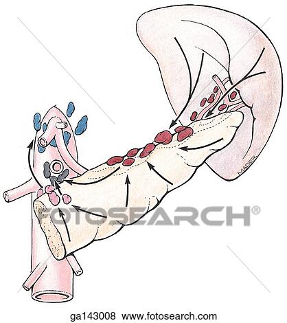 Anterior view of spleen and pancreas, isolated, with color coded groups of lymph nodes. Arrows indicate direction of drainage. View Large Illustration Stock Illustration - Anterior view of spleen and pancreas, isolated, with color coded groups of lymph nodes. Arrows indicate direction of drainage.. Fotosearch