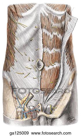 Anterior view of superficial dissection of anterior abdominal wall