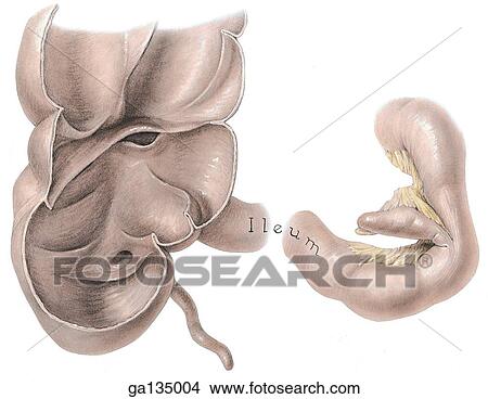 Anterior view of the interior of a dried cecum (left). The cecum was filled with air until dry, opened, and varnished. Also shown (right) is an ileal diverticulum (Meckel's diverticulum), an anomaly near the ileocecal junction. View Large Illustration Stock Illustration - Anterior view of the interior of a dried cecum (left). The cecum was filled with air until dry, opened, and varnished. Also shown (right) is an ileal diverticulum (Meckel's diverticulum), an anomaly near the ileocecal junction.. Fotosearch