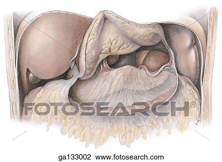 Drawing - Anterior view of the omental bursa and its posterior relationships. The greater omentum and gastrosplenic ligament have been cut along the greater curvature of the stomach and the stomach has been reflected superiorly.. Fotosearch