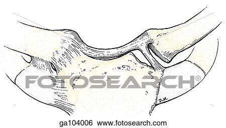 Anterior view of the sternoclavicular joints. The joint capsule has been removed on the left side. View Large Illustration Stock Illustration - Anterior view of the sternoclavicular joints. The joint capsule has been removed on the left side.. Fotosearch
