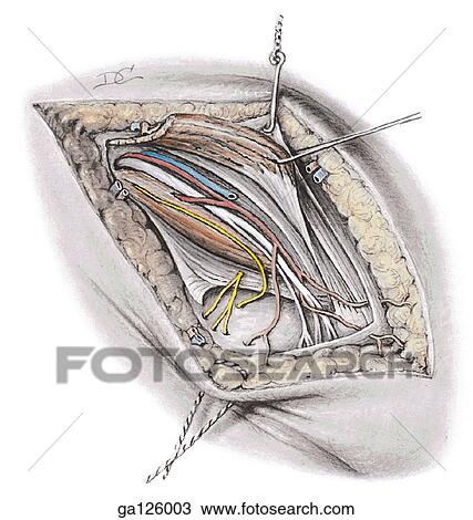 Anterior view of the structures in the female inguinal canal. The internal oblique has been retracted upward to reveal the deep inquinal ring, and the vessels and nerves associated with the round ligament. View Large Illustration Drawing - Anterior view of the structures in the female inguinal canal. The internal oblique has been retracted upward to reveal the deep inquinal ring, and the vessels and nerves associated with the round ligament.. Fotosearch