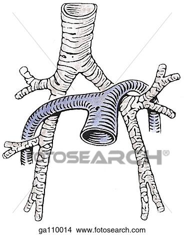 Anterior view of the trachea and pulmonary trunk and their respective branches illustrating their anatomical relationship. View Large Illustration Stock Illustration - Anterior view of the trachea and pulmonary trunk and their respective branches illustrating their anatomical relationship.. Fotosearch
