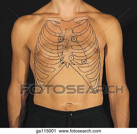 Anterior view photograph of a male thoracic region onto which the ribcage, heart, and four auscultation areas have been drawn. Aortic (A), pulmonary (P), tricuspid (T), and mitral valve (M) areas are shown. View Large Illustration Clip Art - Anterior view photograph of a male thoracic region onto which the ribcage, heart, and four auscultation areas have been drawn. Aortic (A), pulmonary (P), tricuspid (T), and mitral valve (M) areas are shown.. Fotosearch
