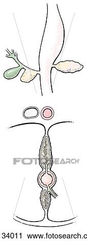 Anterior view (top) and transverse section (bottom) of development of pancreas. Here, small primitive ventral bud arises in common with bile duct and larger primitive dorsal bud arises independently from duodenum. View Large Illustration Clip Art - Anterior view (top) and transverse section (bottom) of development of pancreas. Here, small primitive ventral bud arises in common with bile duct and larger primitive dorsal bud arises independently from duodenum.. Fotosearch