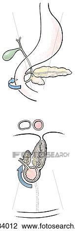 Drawing - Anterior view (top) and transverse section (bottom) of development of pancreas. Here, the 2nd, or descending, part of duodenum rotates to bring ventral bud and bile duct posterior to dorsal bud of pancreas.. Fotosearch