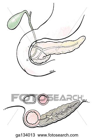 Drawing - Anterior view (top) and transverse section (bottom) of development of pancreas. Here, a connecting segment unites the dorsal pancreatic duct to the ventral duct. Duodenal end of dorsal duct atrophies.. Fotosearch